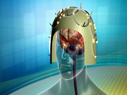 Cutting Edge: Inside the Brain