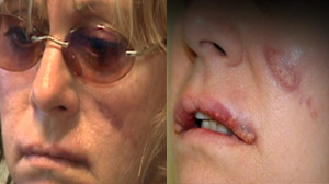 DIT Plastic Surgery