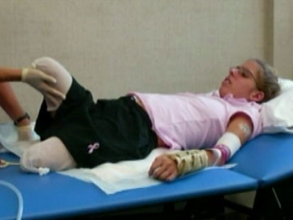 VIDEO: A double amputee in a hospital bed.