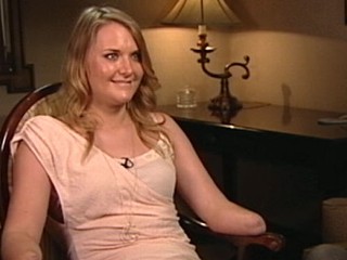 Watch: Aimee Copeland Interview: 'I'm Alive, I'm Celebrating'