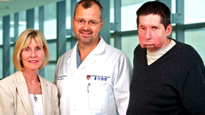VIDEO: Widow Susan Whitman Helfgot writes about donating her husbands face.