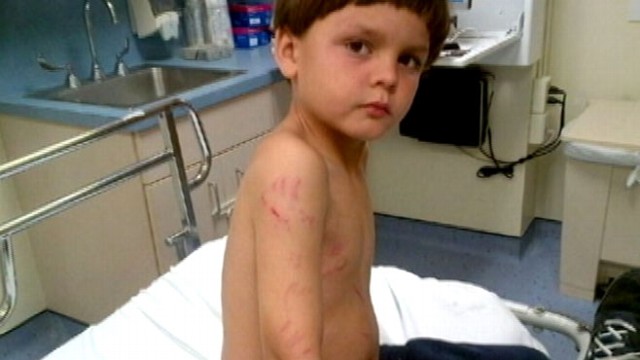 VIDEO: Boy, 6, Saved From Gators Jaws