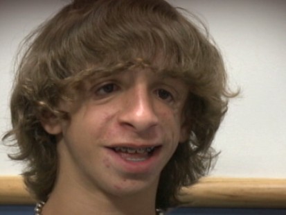 VIDEO: 15-year-olds rare genetic condition left him without some of his face bones.
