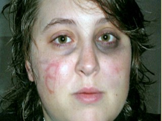 McCain Volunteer Attacked