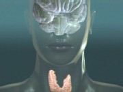 Recognizing Thyroid Disease