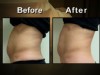 VIDEO: A before and after picture of some one's stomach.