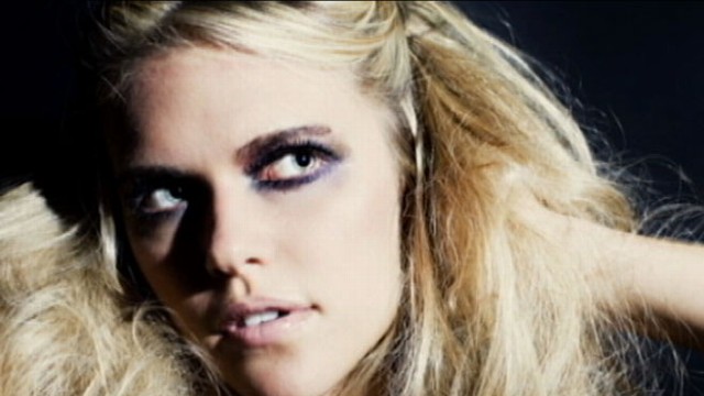 VIDEO: The Texas model who walked into a plane propeller contiues her recovery.