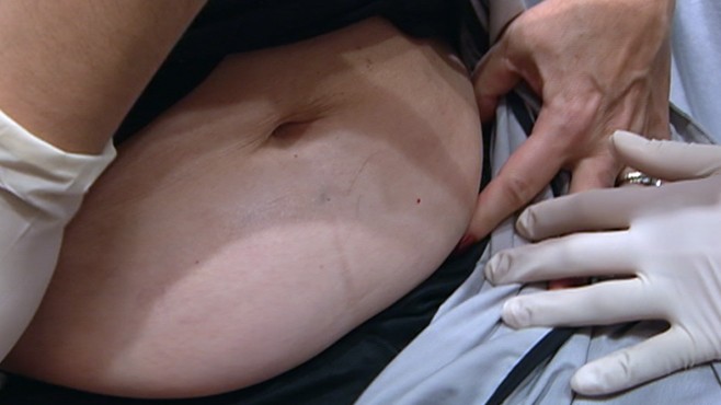 VIDEO: Procedures net positive result, improving patients' appearance with no incision.