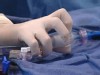 VIDEO: The newly developed valve for heart care.