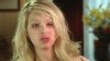 VIDEO: Katie Piper's was badly burned after a man threw sulfuric acid in her face.