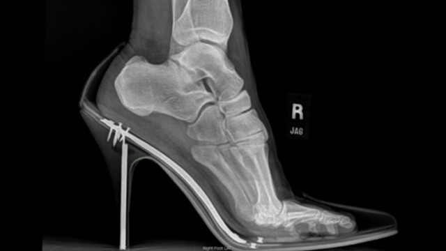 VIDEO: High Heel Shoe Hazards