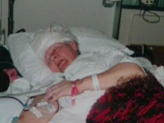 coma