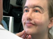PHOTO Chrissy Steltz is shown wearing her prosthetic face.