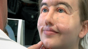 PHOTO Chrissy Steltz is shown wearing her prosthetic face.