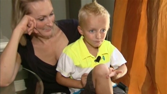 VIDEO: A sea snail egg apparently fell into Paul Franklins cut knee during a California beach vacation.