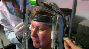 The Future of Stroke Rehabilitation