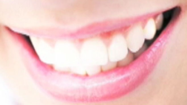 VIDEO: Secrets to a Whiter Smile