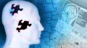 Alzheimers