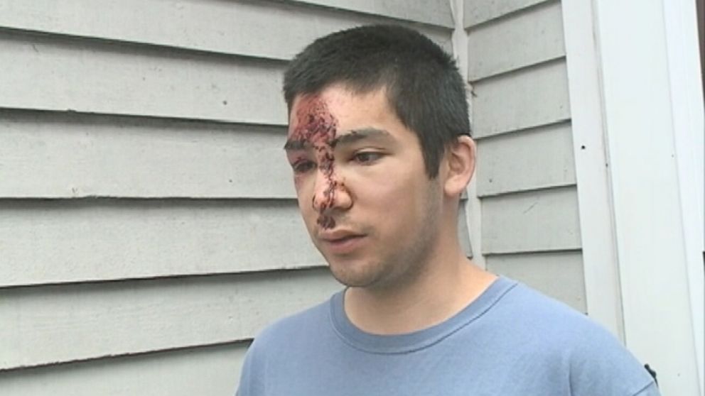VIDEO: Patrick Luk fell several hundred feet off New Hampshires Mt. Adams before crawling to safety.