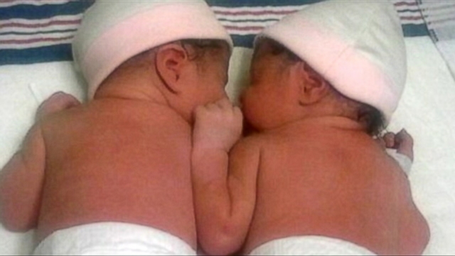 VIDEO: Yaleni Santos Tohalinos children were born minutes apart, but in separate years.