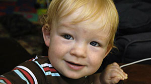 Photo: Sanfilippo Syndrome Type C