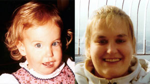 Prader-Willi syndrome