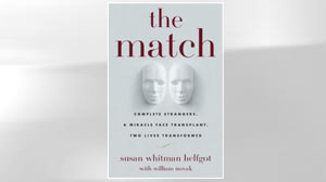 PHOTO The cover of "The Match: Complete Strangers, a Miracle Face Transplant, Two Lives Transformed" by Susan Whitman Helfgot is shown here.