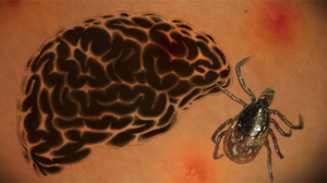 lyme disease