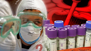 swine flu