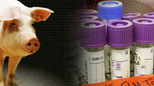 Swine Flu