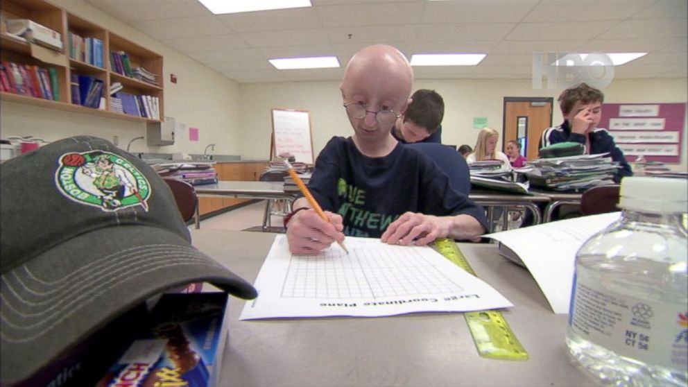 PHOTO: Sam Berns and his family have been leading the fight against progeria
