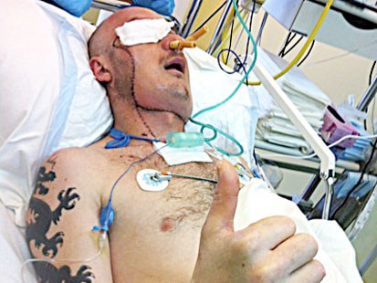 PHOTO: Polish doctors say they saved a man's life by performing a face transplant just three weeks after he was severely maimed in a workplace accident.