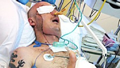 PHOTO: Polish doctors say they saved a man's life by performing a face transplant just three weeks after he was severely maimed in a workplace accident.