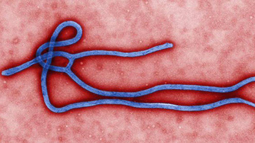 PHOTO: This undated file image made available by the CDC shows the Ebola Virus. 