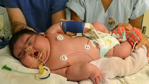 world-record-for-heaviest-baby