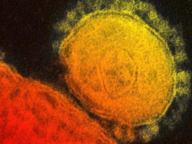 Second US MERS Case Found in Florida