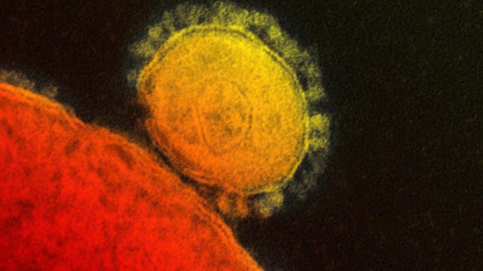 PHOTO: A colorized transmission of the MERS coronavirus that emerged in 2012 is shown in this file photo provided by the National Institute for Allergy and Infectious Diseases.