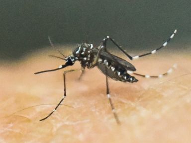 Florida Officials: 3 Pregnant Women Test Positive For Zika Virus