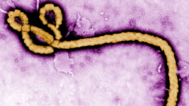 PHOTO: In this handout from the Center for Disease Control, a colorized transmission electron micrograph of a Ebola virus virion is seen. 