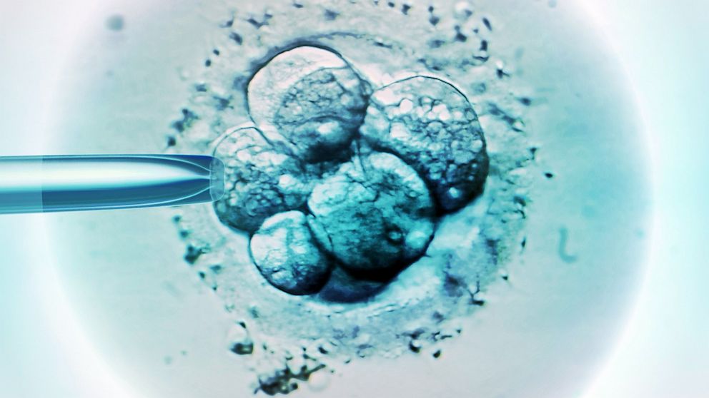 PHOTO: Embryo selection for IVF light micrograph.