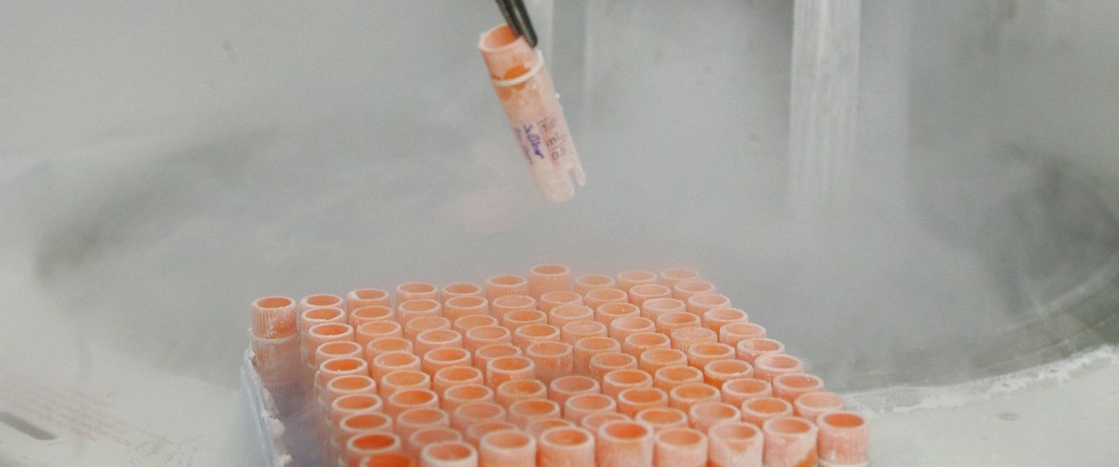 Reported Breakthrough in Growing Embryos in Vitro Could Raise Ethical Issues for Research 