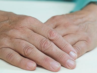 Weird Signs of Health Troubles