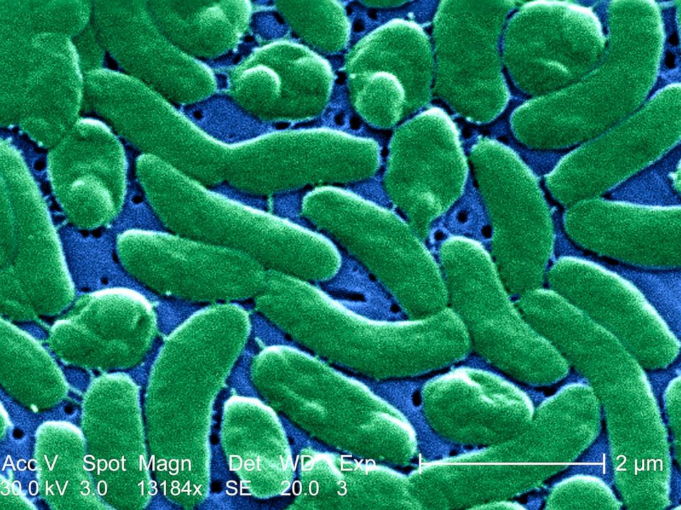 PHOTO: A grouping of Vibrio vulnificus bacteria is pictured in this micrograph.