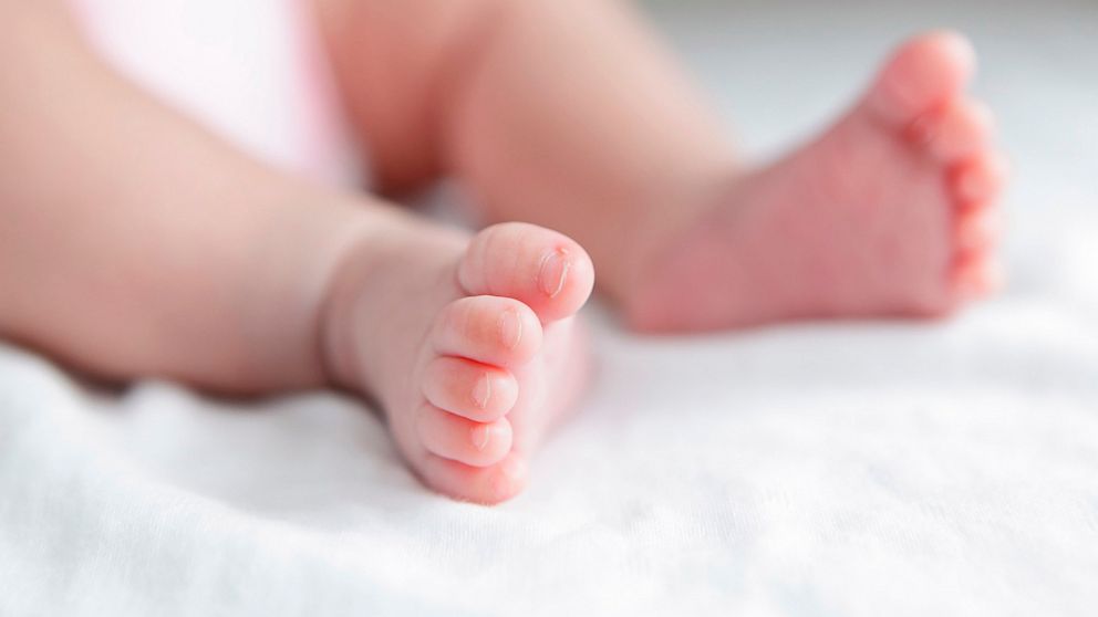 PHOTO: Home Births vs. Hospital Births