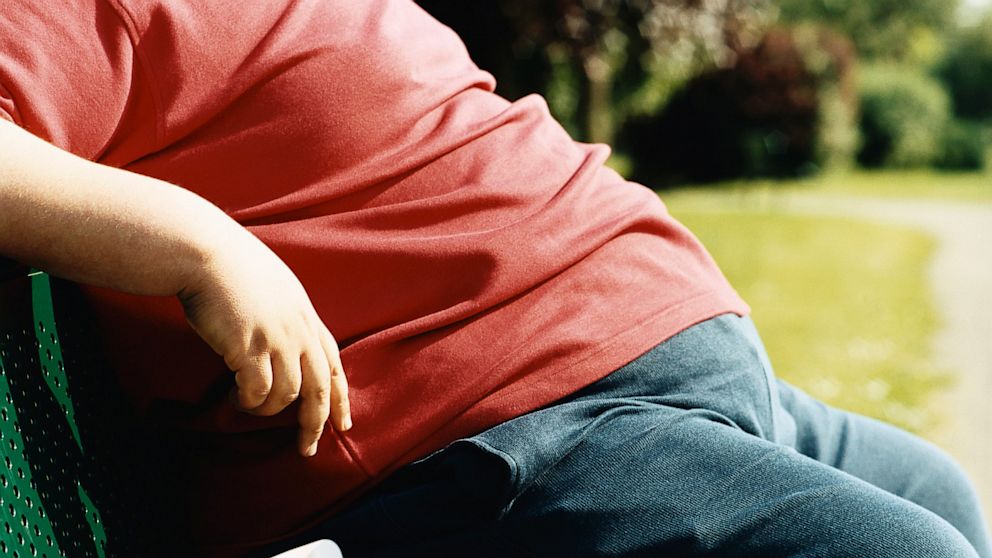 PHOTO: obesity