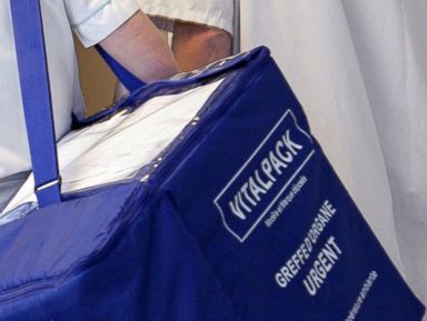 Would You Donate Your Face When You Die?