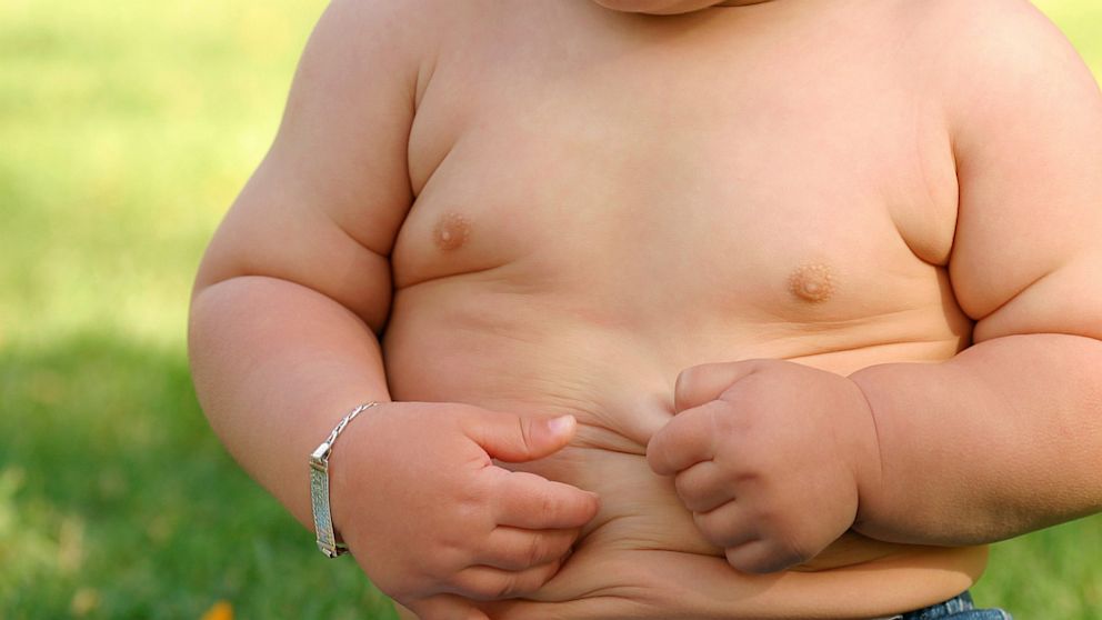 PHOTO: No Increase In Obesity Rates