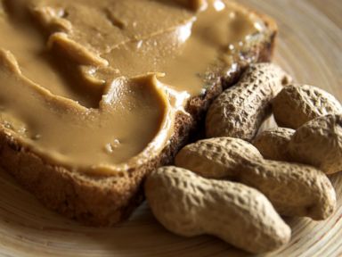 Early Peanut Exposure May Reduce Allergies, Study Finds