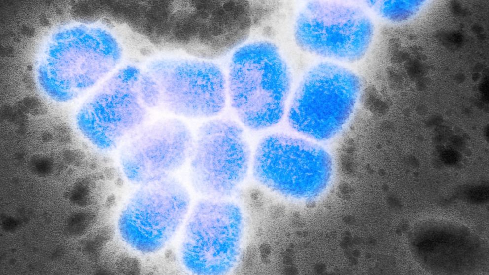 PHOTO: Transmission electron micrograph of smallpox particles, or virions.