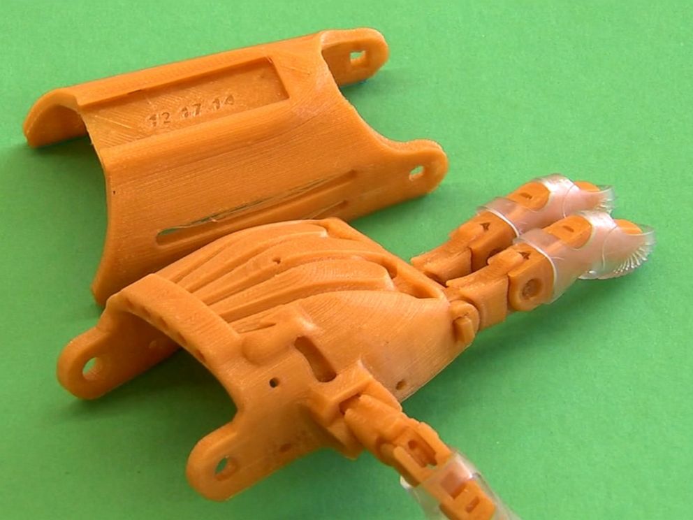 PHOTO: Eighth-graders at Howard B. Mattlin Middle School in Plainview, New York, are using a 3-D printer to create prosthetic hands for other children in need of them.